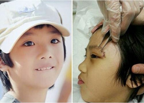 芒果台回应Feynman受伤:未收到理赔所需文件 芒果台回应Feynman受伤:未收到理赔所需文件