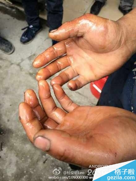 小伙玩小米手机突然爆炸 小米已回应