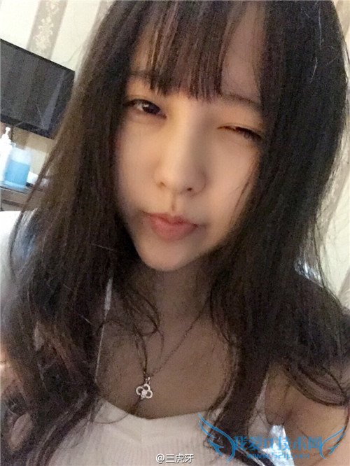 斗鱼 斗鱼tv 斗鱼直播 斗鱼tv直播平台 斗鱼小虎牙