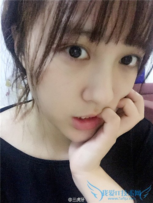 斗鱼 斗鱼tv 斗鱼直播 斗鱼tv直播平台 斗鱼小虎牙