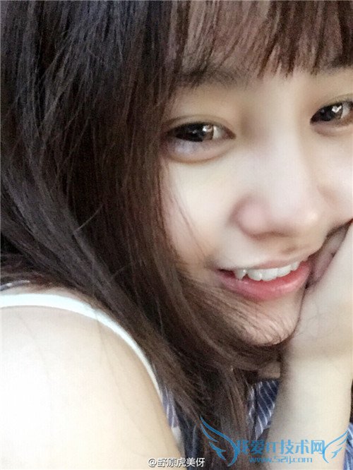 斗鱼 斗鱼tv 斗鱼直播 斗鱼tv直播平台 斗鱼小虎牙