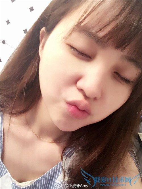 斗鱼 斗鱼tv 斗鱼直播 斗鱼tv直播平台 斗鱼小虎牙