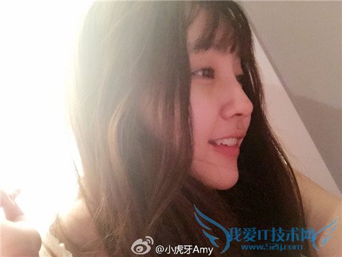 斗鱼 斗鱼tv 斗鱼直播 斗鱼tv直播平台 斗鱼小虎牙