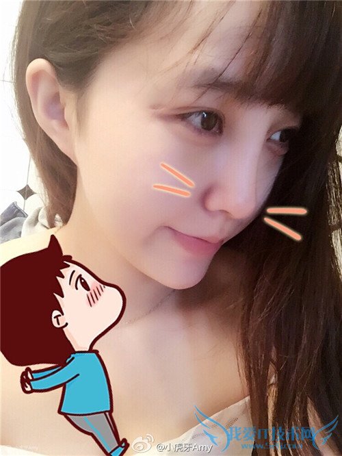 斗鱼 斗鱼tv 斗鱼直播 斗鱼tv直播平台 斗鱼小虎牙