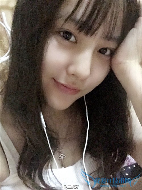 斗鱼 斗鱼tv 斗鱼直播 斗鱼tv直播平台 斗鱼小虎牙