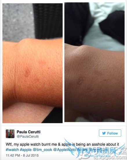 Apple watchƤ Apple Watchݡš