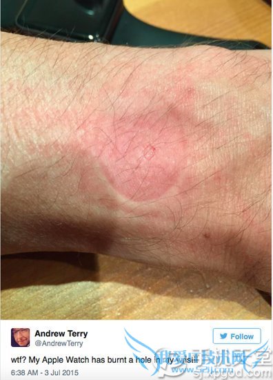 Apple watchƤ Apple Watchݡš