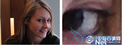 让你的手机拍照更清晰?个小€