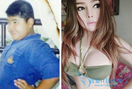 灵与肉的较量:男胖墩变性成巨乳辣妹的惊人逻辑 灵魂不具可控性,肉体却相反,可控性极高。当人的灵魂与肉体发出冲突时,便衍生了这样一个问题:是灵魂屈就于肉体?还是肉体妥协于灵魂呢? 在高盛菡看来,出轨与变性皆是灵魂与肉体博弈的产物。对于出轨者来说,人们对灵魂上的背叛缺乏自控力,但人类却完全具备对肉体的自控力,据此,所谓的出轨只都不过是一种借口。然而,变性者的逻辑思维是惊人的,对于他们来说,灵魂与肉体的背叛呈现出一种截然不同的情况:他们肉体所属的性别与灵魂中的认同并不一致,需要通过手术的方式强行使肉体屈就于灵魂。 变性人的存在 变性的过程,就是一场场灵与肉激烈较量的过程,较量不仅仅发生在遍地人妖的泰国,也发生在世界的其他角落。 日前,泰国一名巨乳辣妹在 Facebook 上承认自己是变性人,并秀出自己童年时的样子。令人难以置信的是,照片中皮肤黝黑的男胖墩与白皙的巨乳辣妹出自同一副躯壳,变性前后形成惊人的对比,激起全球网民的围观与讨论。 基于大数据和常识,巨乳辣妹所在的泰国荣登“全球变性人比例最高国家”宝座。在泰国,政府对男性是否可以自主选择变性给出了立法规定,而且还创办“变性人”大学,以期能够确保准变性人或变性人有自尊地生活,不遭受白眼和偏见。9 月 6 日晚,一位名叫蒋伟豪的中国男钢管舞教练,一心想要变成女人,慕名飞到泰国进行下体手术,则恰恰证明了泰国在“变性”方面的权威性。 提到中国的变性人,据说香港人中每 300 个就有一个变性人,而内地的变性人数则没有可靠的数据。除刚刚提到的蒋伟豪之外,著名化妆师吉米也一再宣称要在变性后“找个西方猛男嫁了”,但可惜的是“雷声大雨点小”,至今仍不时“空喊变性口号”,未付出实际行动,相较而言,陈莉莉、金星、刘诗涵则可以称得上是“变性人当中的真汉子”,言行一致,早已完全摆脱灵与肉的折磨,通过手术实现了魂牵梦萦的女人梦。 变性人的尴尬 大多数变性人之所以会陷入“灵与肉”的较量之中,是因为他们患有精神医学用语所说的“性别认同障碍”。存在这种障碍的人,在幼年时期就已表现出对自身肉体性别角色的不适应,而随着年龄的增长,这种不适应性会逐渐增强,直到自己的内心无法忍受肉体的特征。由此,变性虽然尴尬,但却是他们灵魂与肉体实现统一的唯一方式。 此外,对于想要变性的人来说,实现梦想的唯一手段只有变性手术。但高额的手术费用,并不是每个“性别认同障碍”者都能承受得起,男性变女性的手术费用大概至少需要 20 万,女性变男性因为更复杂和繁琐,手术费至少需要 40 万。对于负担不起高额手术费的人来说,他们只能依靠激素疗法以求得灵魂与肉体的统一,但滥用激素和药物,对身体的伤害也同时骤增。 对于变性人来说,他们是最为尴尬的,也是弱势群体中得到最少包容最多质疑的一类人。除了灵魂不认同自身肉体特征之外,他们遭遇到嘲笑的痛心与变性手术的痛身一起,构成了终身难以抹去的两道伤痕。 虽然,变性人的道德观与价值观存在边缘性,但是他们对于灵魂与肉体统一的追寻无疑是值得尊重的。所以,高盛菡敢请各位看官卸下“有色眼镜”,品味变性人的思维逻辑,用同情取代嘲笑,以生命的名义尊重他们的选择与权利,公平看待“灵与肉的较量”。