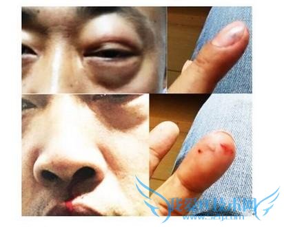 ڡˮ̶ҽԺ“˳˰”ҽ¼ࡷУ˼˫֫ͻģ˼ǱģҪǷԷ