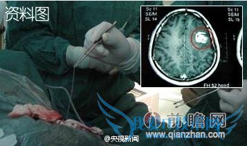 11 ͯտڳ 7 ׳ ԻǸϽѹѹ