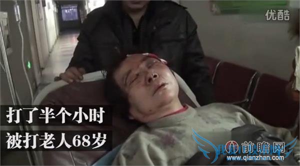 女子暴打六旬老太满地血:我眼镜 3 万多,比你命都值钱