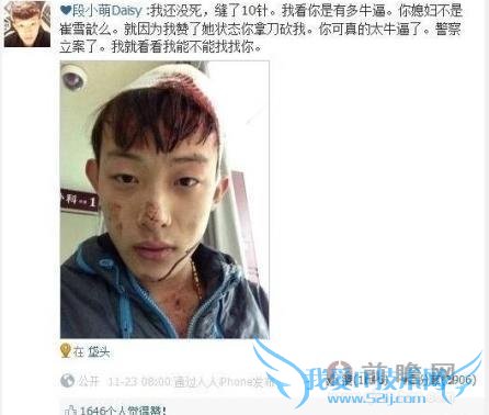 男子给别人媳妇点赞被砍伤:点个赞也能招来杀身之祸
