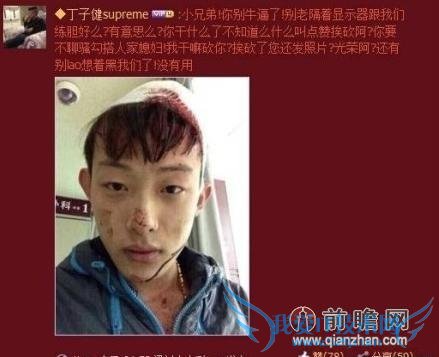 男子给别人媳妇点赞被砍伤:点个赞也能招来杀身之祸