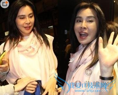 ٻŮĻ꡷Ѧ׽վ ˸ͷ