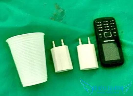 什么都敢吞!巴西一囚犯将手机和充电器吞进肚子藏起来