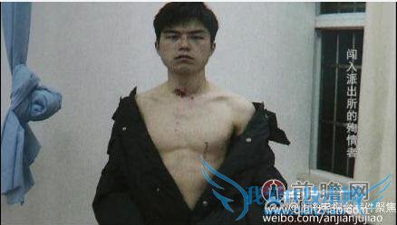 男子捅女友 20 刀后自杀奇遇:跳河河水及腰 自刎弄卷刀口