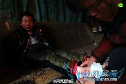 ֽкƤһ ҽԤԻ 3 ͦ 8 ͷ