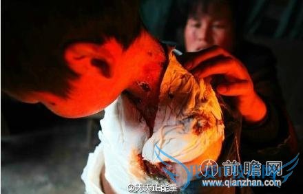 ֽкƤһ ҽԤԻ 3 ͦ 8 ͷ