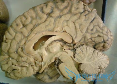 һ͵Ա걾ϳ۱ 4  ר͵