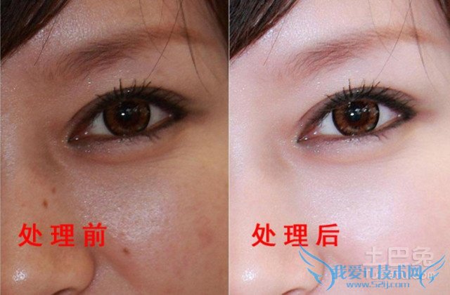 如何使用photoshop