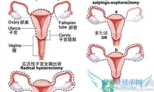 �ӹ���������ԭ��