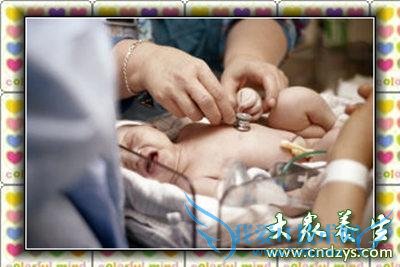 ����������������ƿ�ѡ��ˮԡ�Ʒ���(2)