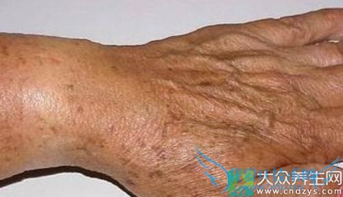 ���˰ߵ���������