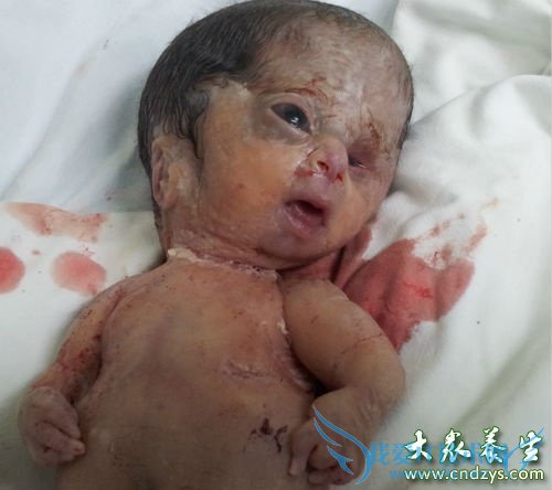 ����̥�����ε�ԭ��