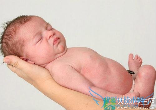 ��������֢״