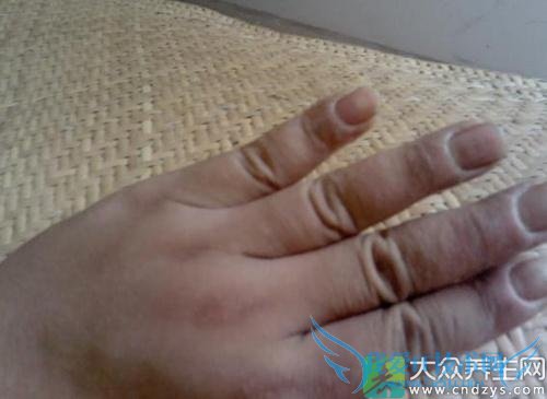 Ƥ��ʪ������Ʒ���