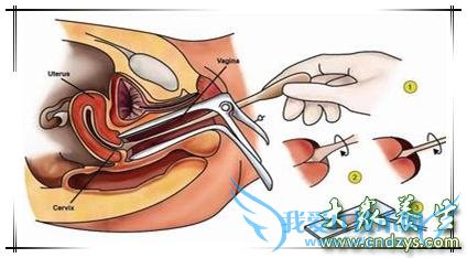 ������Ƭ���Ӧ��ע����Щ���⣿(1)