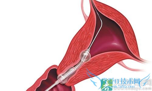 �ӹ���λ��ԭ��