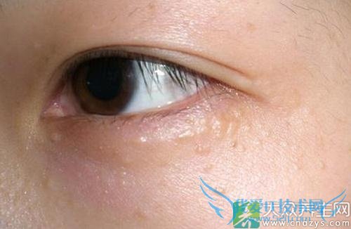 �۲�֬������ôȥ��