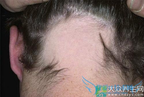 �����԰�ͺ��ԭ��