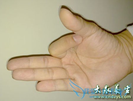 Ů��������Ѫ��������12��(2)