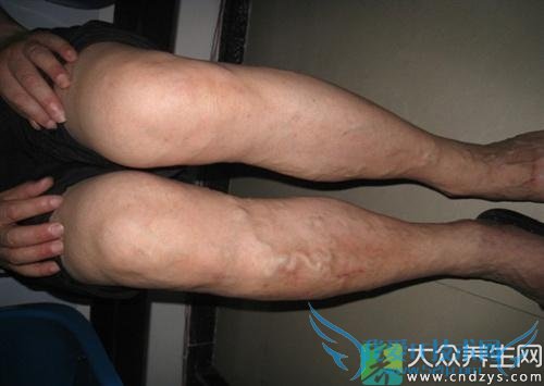 �������ŵı���