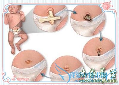 ����೤ʱ���ܡ�Ȭ���������껤����ע������(1)