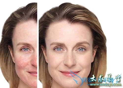 �沿��ëϸѪ������Ҫ��ô����