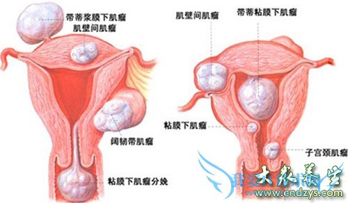 Ů��˽�ܲ�λ�°������а�(3)