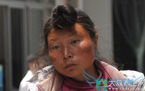 ���񲡵Ĳ���