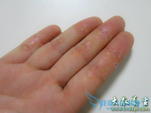 Ů������Ҫ�Ŷ��ľŸ�Ԥ��֢״(9)