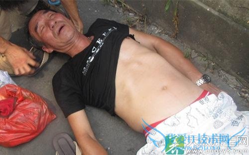 ��֢���Ե�֢״ 