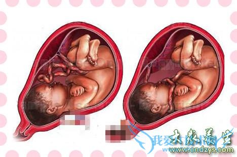 ̥������ƾ���˳��������ƾ���ǰ���(1)