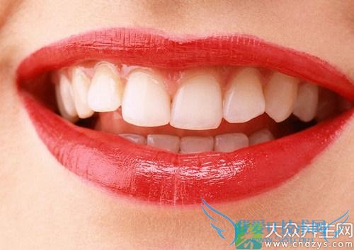 �촽������ô�� 