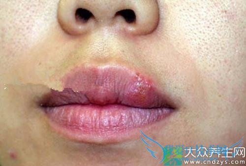 Ӥ���������Ǻ�������Ϊʲô?(1)