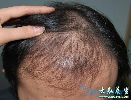 ��������ѷ���������(1)