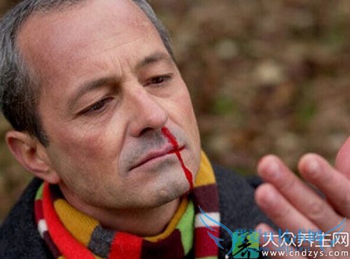 �����˱ǳ�Ѫ��ʲô��