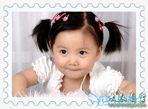 �������ӵ�ԭ��������Ƥ��������֢(2)