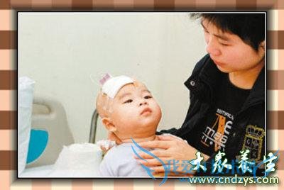 ������Ĥ�׵�ԭ��ͷ��δ�ʩ(2)